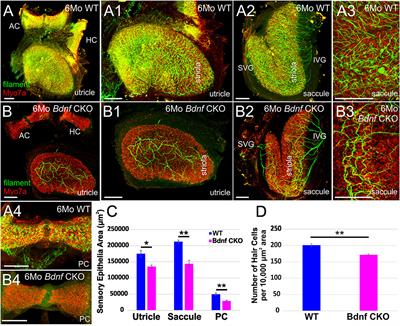 Sustained Loss of Bdnf Affects Peripheral but Not Central Vestibular Targets